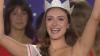 Katia Buchicchio, Miss Italia con il dispositivo ortodontico: una bellezza autentica